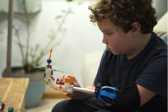 “乐高”男孩：3D打印改变了残障人士的生活