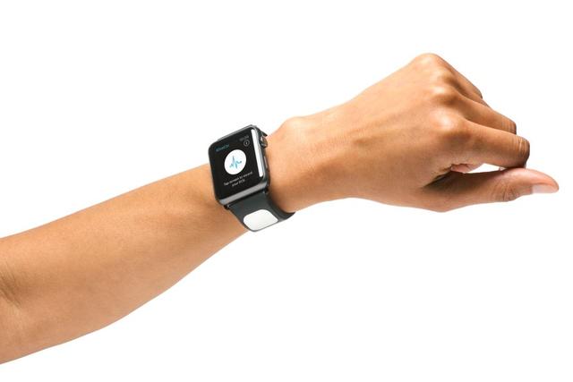 这款Apple Watch医用表带可以检测心率预防中