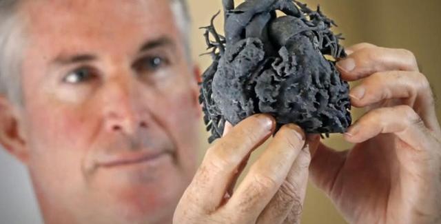 医生使用3D打印心脏模型救4岁女童一命