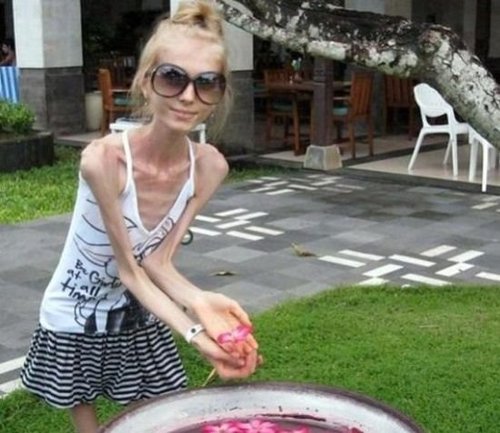 美女最瘦美女:俄罗斯世界暴瘦至20kg.(女人图)排行网络少数民族图片