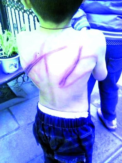 ΢ͼƬʾСкбŹӡۡ