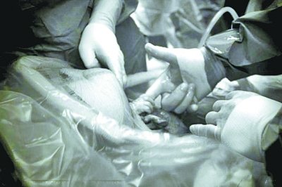 剖腹产女婴从母亲子宫中伸手<em>抓住</em>医生手指_教