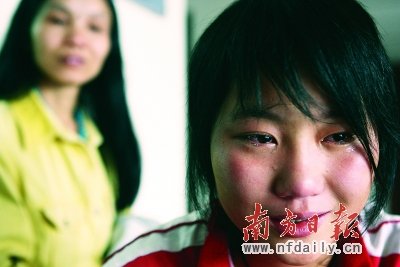回访国内年龄最小心肺联合移植患者：活着就好