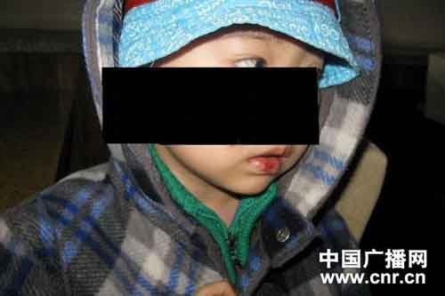 河北燕郊一幼儿园涉嫌虐童 教育局表示管不了
