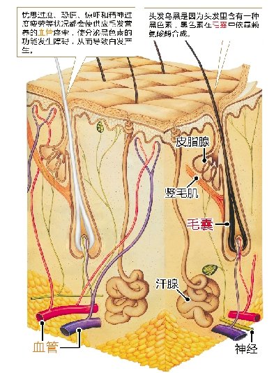 女孩“少白头”一次手术后变黑 四学科专家各有说法