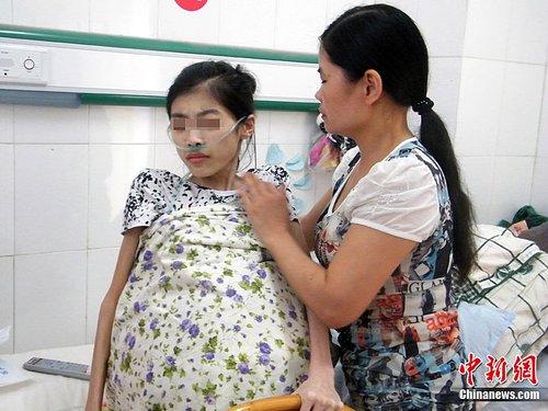 高中女生患怪病肚子大过孕妇 靠止痛药度日(图