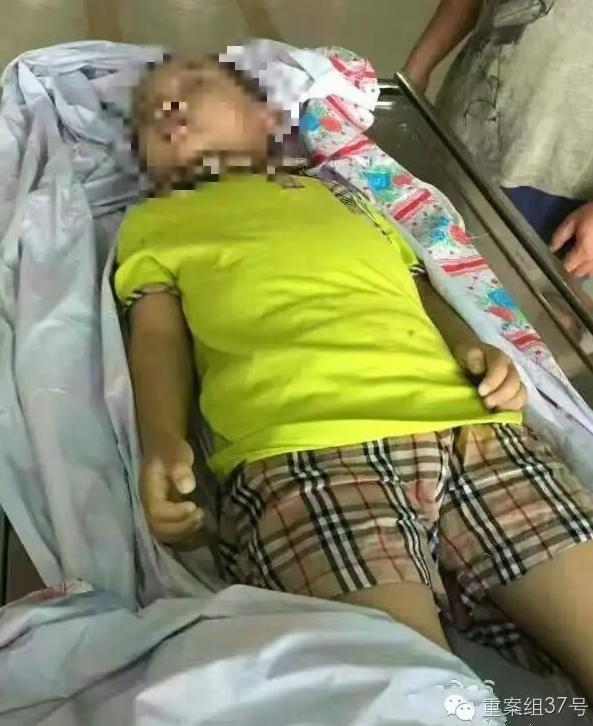 厦门4岁男童在幼儿园窒息身亡 脖子有明显勒痕