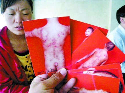 河南13岁男孩去学杂技 在宁夏遭老板长期殴打