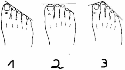 看<em>脚</em>识<em>女人?</em>网友纷纷对号入座_教育_腾讯网