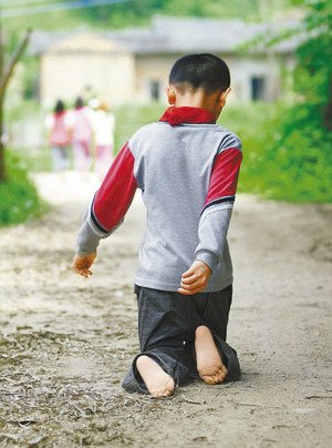 坚强少年天生残疾以膝代步 4年坚持跪行上学