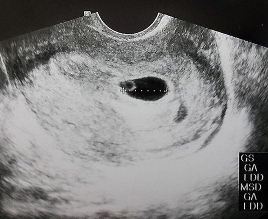 帐号更新成"我当爸爸了,并晒出宝宝的超声波照,宣布妻子崔贤珠怀孕