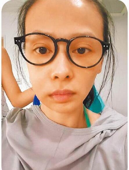 萧淑慎因牙疼脸肿变形 自称内地商演月入50万