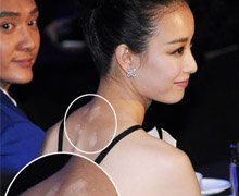 ��ͼ�������񱳾�¶��Ƭ�۵� �������ڸǰߺ�