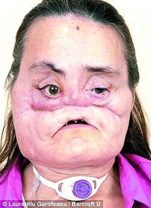 像《重生》的马可那样整出张新脸靠谱吗?