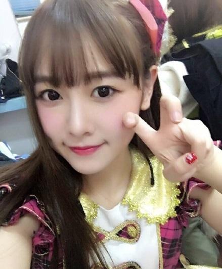 snh48唐安琪系特重度烧伤 医生教授自救方法