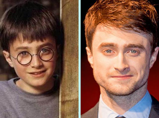 童星今非昔比尽长残 张一山鱼尾纹明显俏皮不再