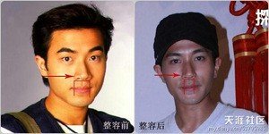 炎亚纶整容 盘点整容的男星惊悚照(图)_娱乐_腾