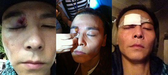 新《黄飞鸿》拍群斗戏 蔡少芬老公张晋右眼险失明