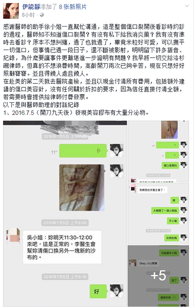 伊能静晒剖腹产伤口照片 反击美医师不认账行为