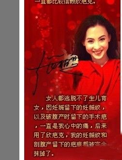 祛妊娠纹产品排行榜新宠_2019祛妊娠纹产品排行榜祛妊娠纹产品品牌排名(2)