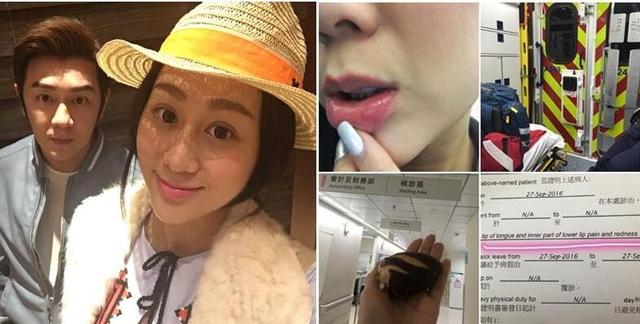 吃面包烫伤被送急救 陈浩民否认滥用救护车资源