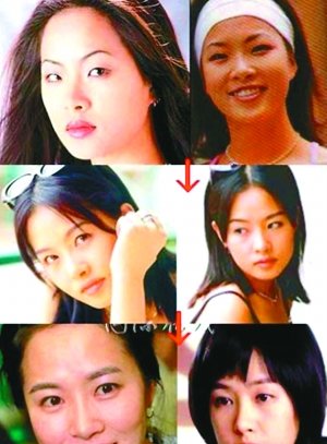 韩国整容医院资料外泄 蔡琳金善雅“现原形”【图】