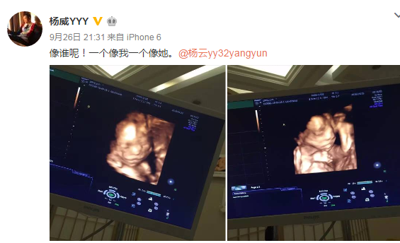 杨威妻子再怀双胞胎 一个像他一个像她(图)
