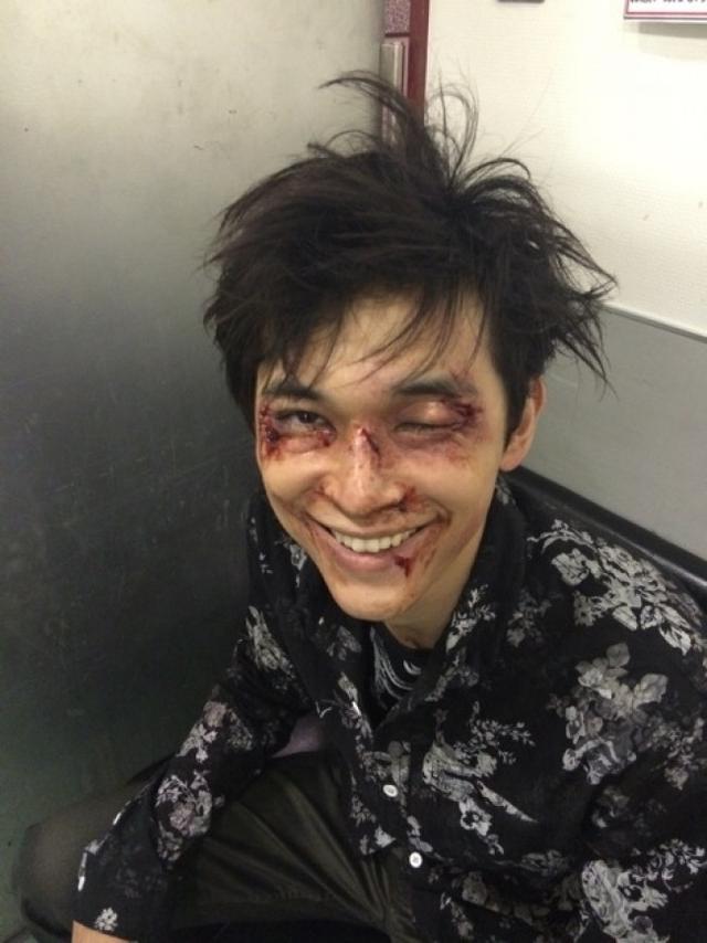 吉沢亮晒《玩命警探》“破相”妆 引粉丝哀嚎