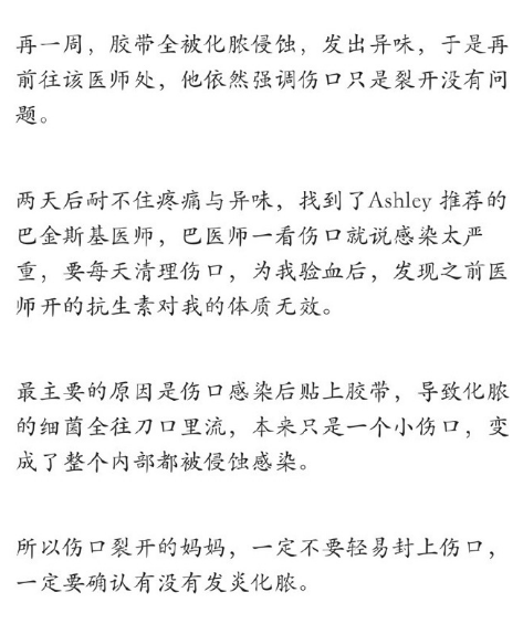 伊能静产后伤口感染 再次入院开刀治疗
