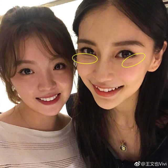 八公举：不笑运气差，爱笑脸会大 ……哦对了，还长纹。