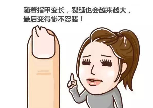 剪指甲时满天飞,居然是不正常的?!