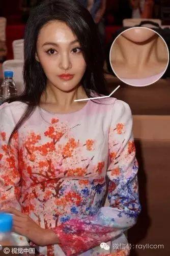 没开玩笑!N年后杨紫的暴瘦颈=赵雅芝的褶皱