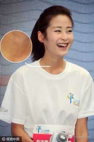 没开玩笑!N年后杨紫的暴瘦颈=赵雅芝的褶皱