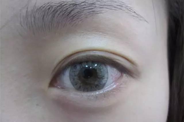 买的美瞳露眼白怎么办,买的美瞳露眼白怎么办啊