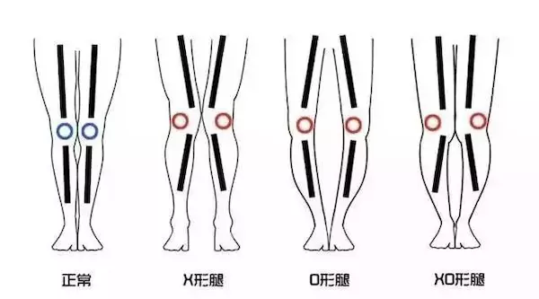 根据腿型挑牛仔裤,杨幂XO型腿都能穿得美美的