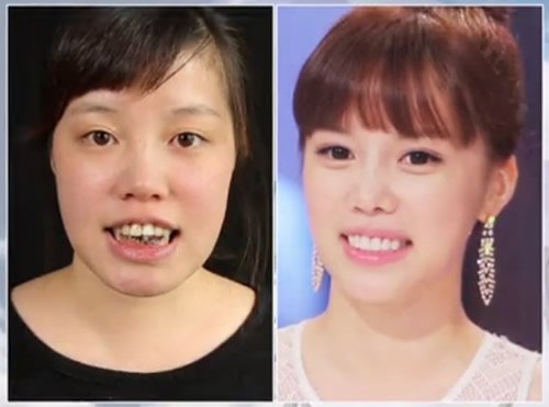 韩国整容节目真人秀:丑女变美人震惊网络_时尚_腾讯网