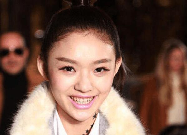 林允公开亮相戴假牙，刘涛拍戏时牙齿竟然飞出去了!