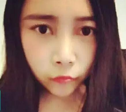 把凤姐整成angelababy总共分几步