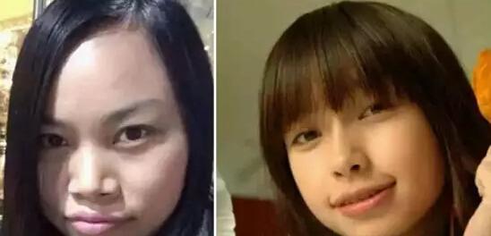 把凤姐整成angelababy总共分几步