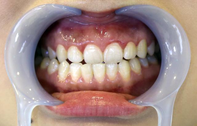 天噜啦!靠一嘴小白牙儿征服世界