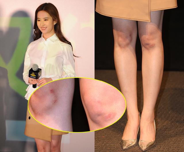 八公举:郑爽宋慧乔都有15岁的脸50岁的“丑膝盖”