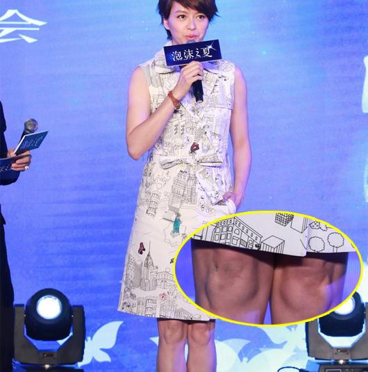 八公举:郑爽宋慧乔都有15岁的脸50岁的“丑膝盖”