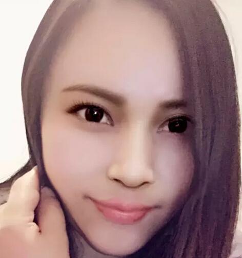 把凤姐整成angelababy总共分几步