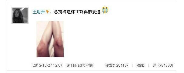 八公举:郑爽宋慧乔都有15岁的脸50岁的“丑膝盖”