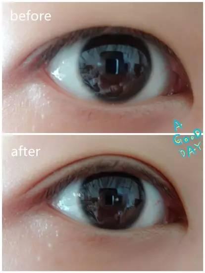 最新双眼皮贴！周冬雨刘诗诗贴得真好看。