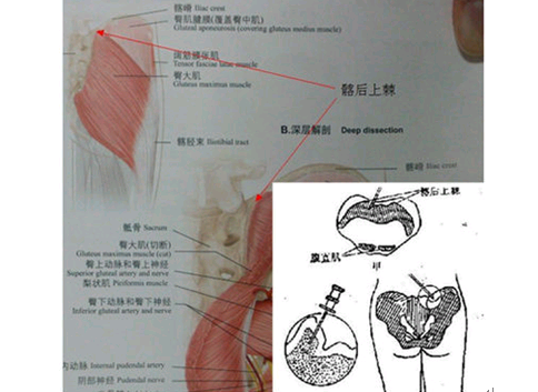 凡人观时尚:用腰窝来鉴定是否性感有些欠妥