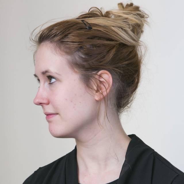 外国人得到韩国整形医生整容方案后,凌乱了不