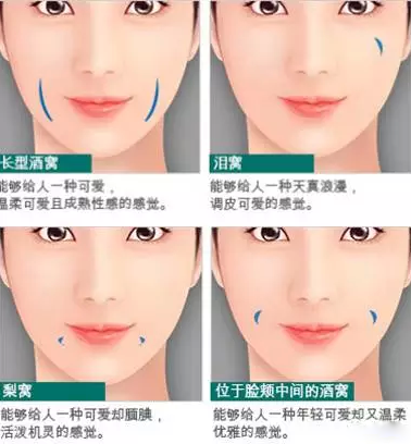 酒窝是种面部残疾? 漂亮就行!