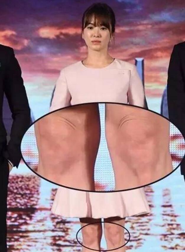 八公举:郑爽宋慧乔都有15岁的脸50岁的“丑膝盖”