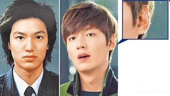 韩国男艺人被指整容 金秀贤整鼻子李敏镐修脸
